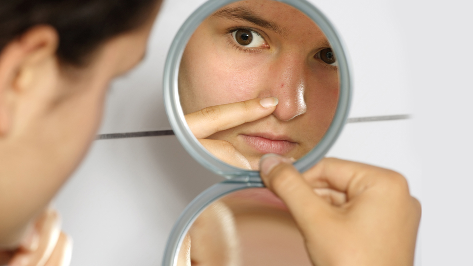 combatir el acne, como combatir el acne, como eliminar el acne, eliminar acne, eliminar en cara